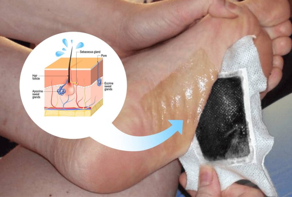 Example of how foot patches change their color after detox